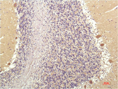 SGK1(4D12)Mouse Monoclonal Antibody