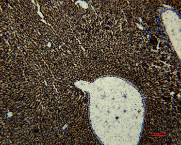 Transferrin(1B12)Mouse Monoclonal Antibody