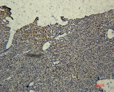 Transferrin(2F2)Mouse Monoclonal Antibody