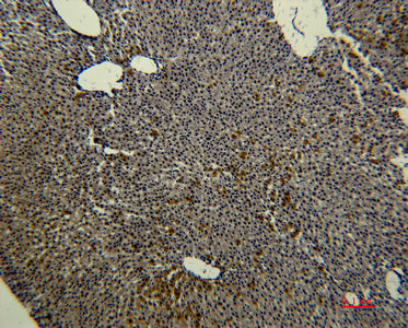 Transferrin(3A5)Mouse Monoclonal Antibody