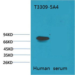 Transferrin(5A4)Mouse Monoclonal Antibody