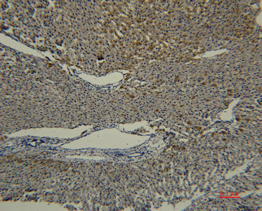 Transferrin(5E5)Mouse Monoclonal Antibody