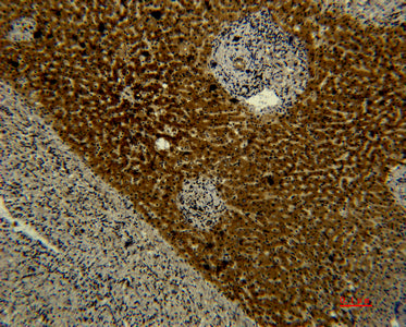 Transferrin(5F9)Mouse Monoclonal Antibody