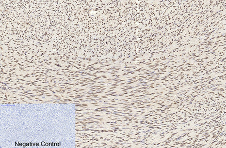 Histone H3 Monoclonal Antibody(1G1)
