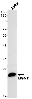 MGMT Rabbit Monoclonal Antibody