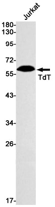 DNA Nucleotidylexotransferase Rabbit Monoclonal Antibody