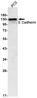 E Cadherin Rabbit Monoclonal Antibody
