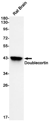 Doublecortin Rabbit Monoclonal Antibody