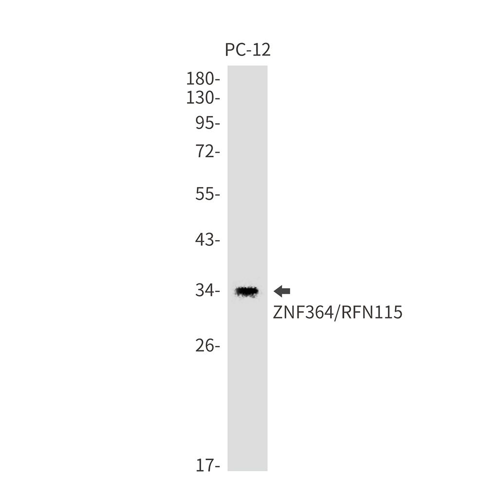 ZNF364 Rabbit Monoclonal Antibody
