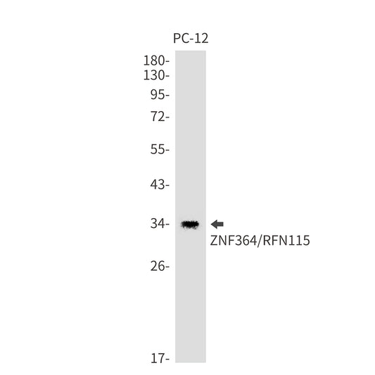ZNF364 Rabbit Monoclonal Antibody