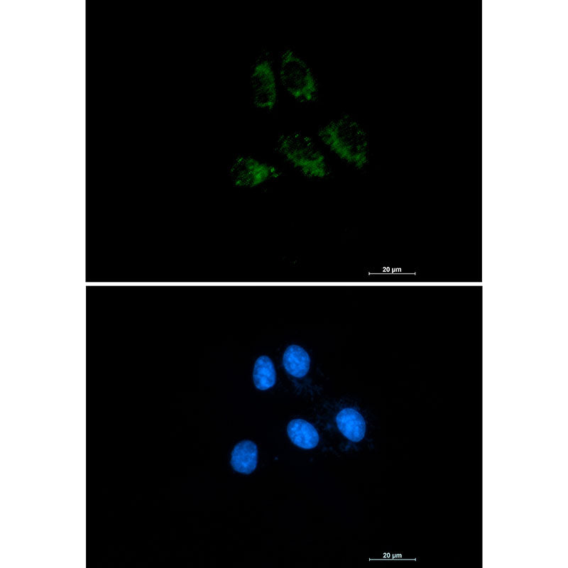 Thrombomodulin Rabbit Monoclonal Antibody