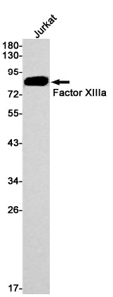 Factor XIIIa Rabbit Monoclonal Antibody