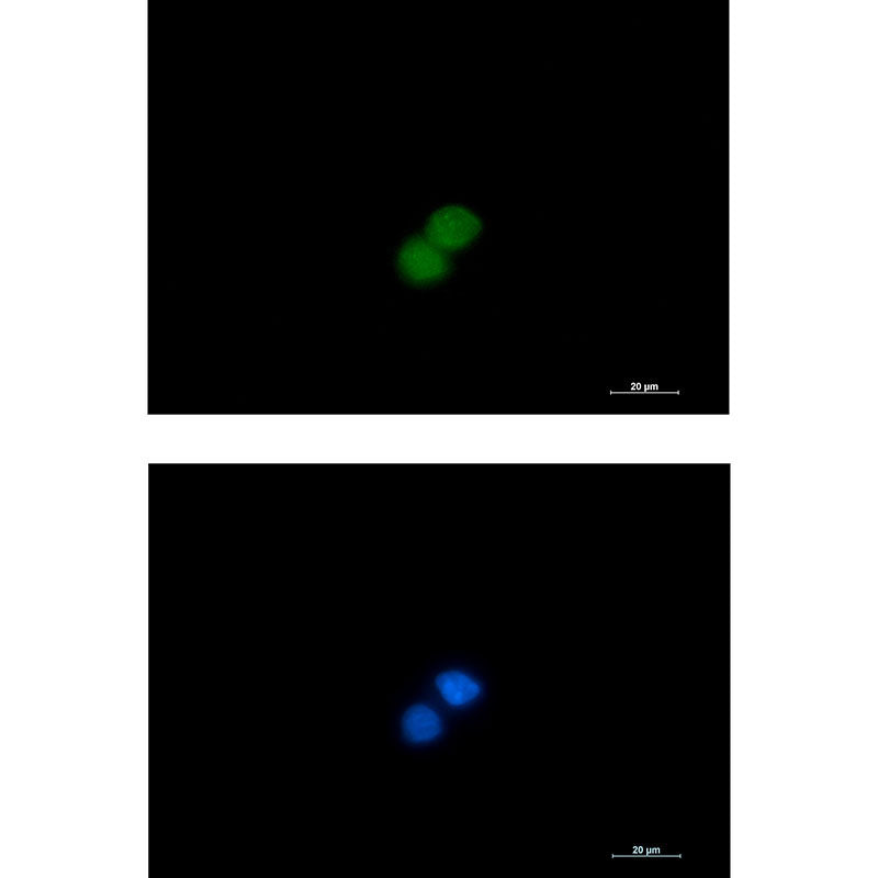 MSP Rabbit Monoclonal Antibody