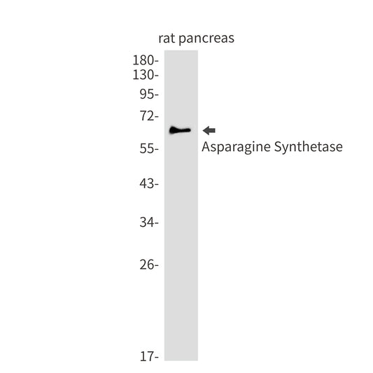 Asparagine Synthetase Rabbit Monoclonal Antibody