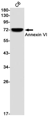 Annexin VI Rabbit Monoclonal Antibody