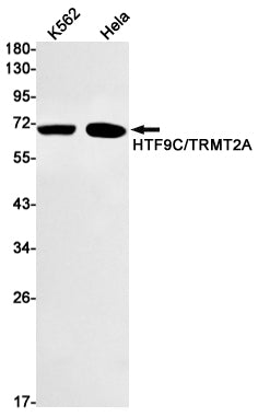 TRMT2A Rabbit Monoclonal Antibody