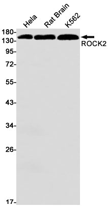 ROCK2 Rabbit Monoclonal Antibody