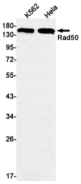 Rad50 Rabbit Monoclonal Antibody