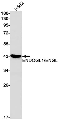 ENDOGL1 Rabbit Monoclonal Antibody