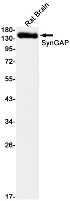 SynGAP Rabbit Monoclonal Antibody