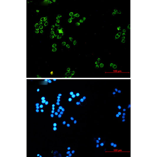 Lipoamide Dehydrogenase Rabbit Monoclonal Antibody