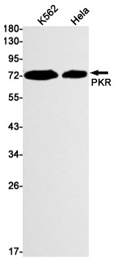 PKR Rabbit Monoclonal Antibody
