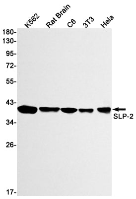 SLP2 Rabbit Monoclonal Antibody