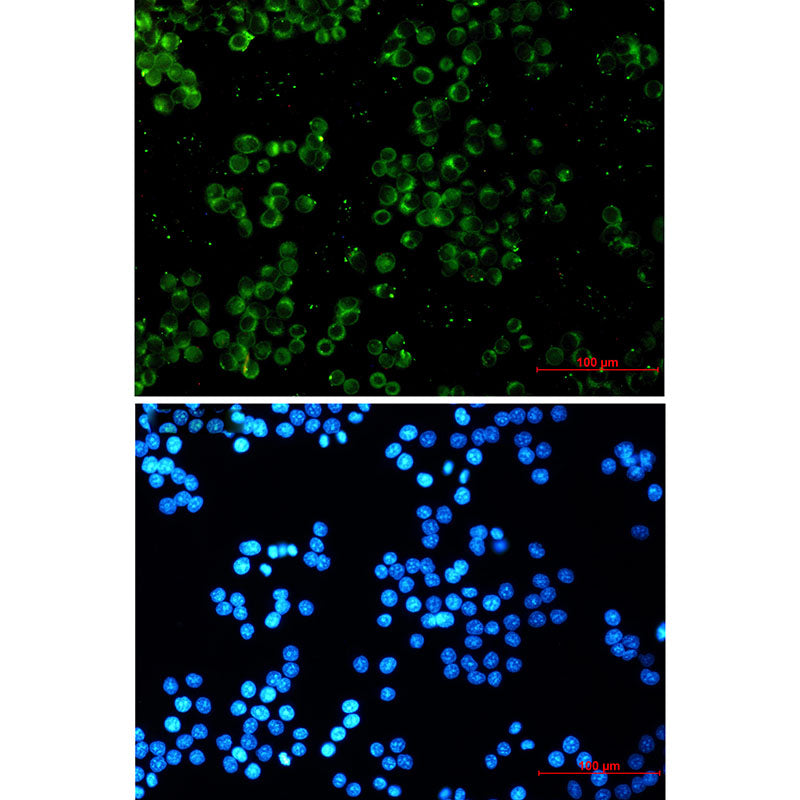 TREX1 Rabbit Monoclonal Antibody