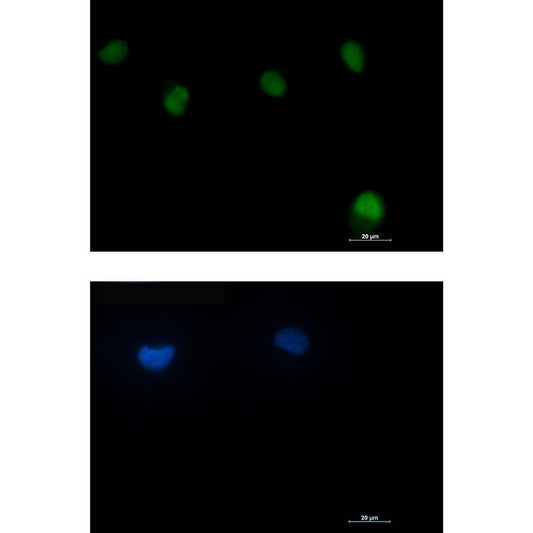 ATM Rabbit Monoclonal Antibody