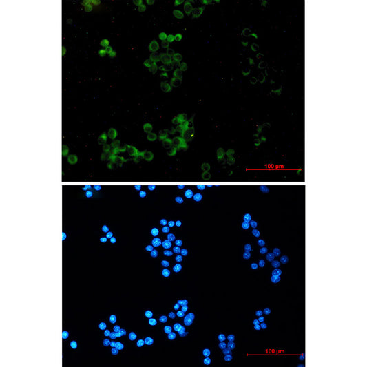 Amyloid Precursor Protein Rabbit Monoclonal Antibody