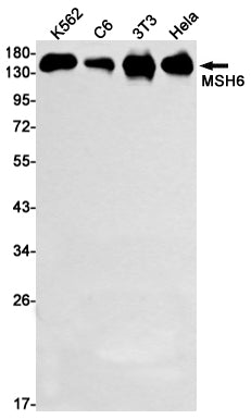 MSH6 Rabbit Monoclonal Antibody