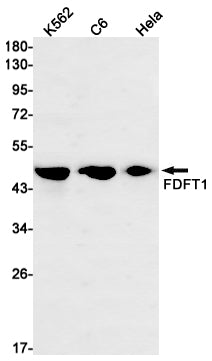 FDFT1 Rabbit Monoclonal Antibody