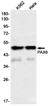 PAX6 Rabbit Monoclonal Antibody