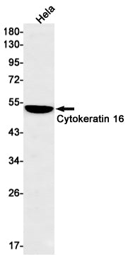 Cytokeratin 16 Rabbit Monoclonal Antibody