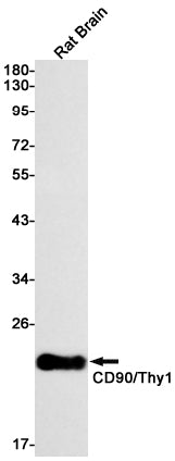CD90 Rabbit Monoclonal Antibody