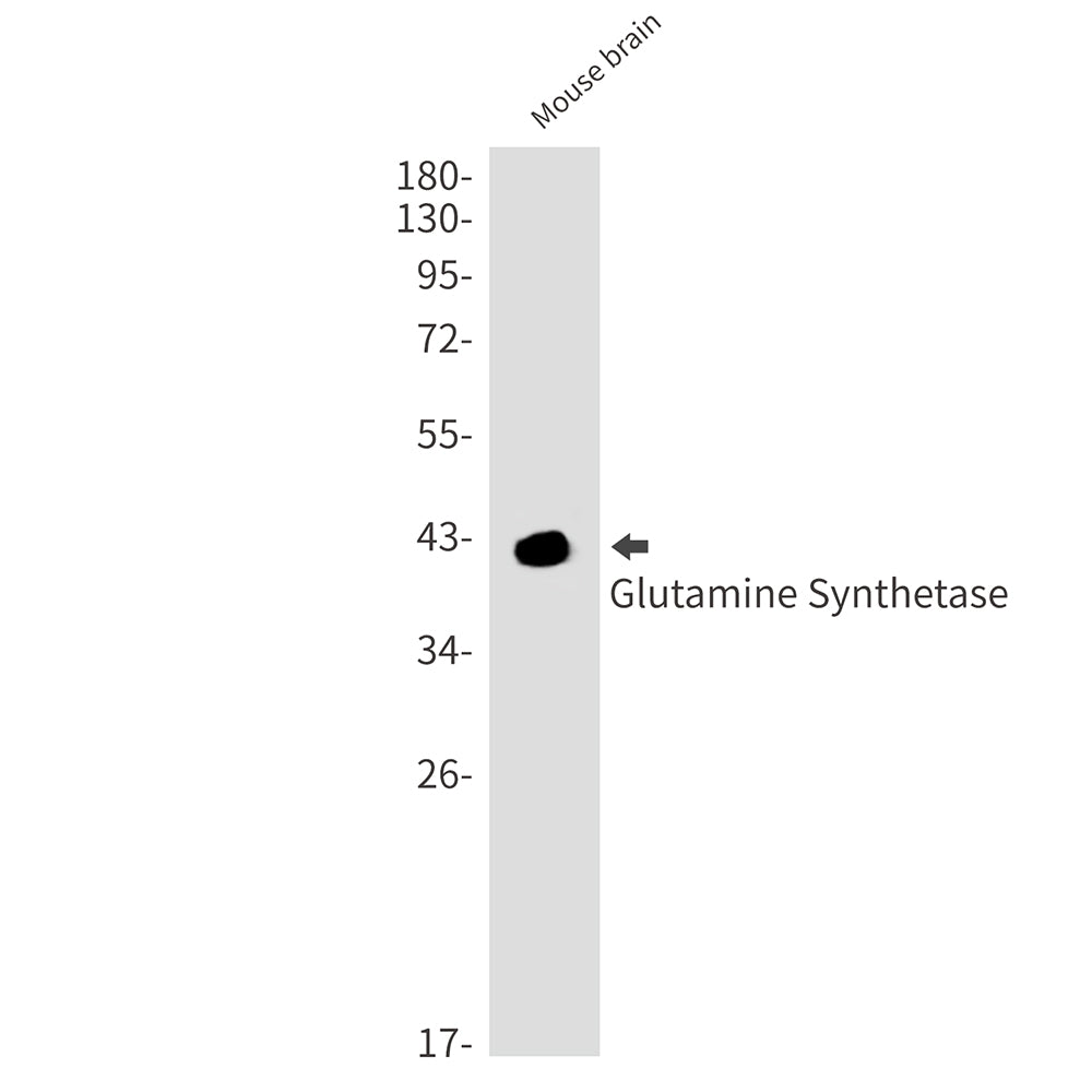 Glutamine Synthetase Rabbit Monoclonal Antibody