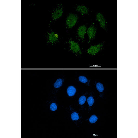 Smad3 Rabbit Monoclonal Antibody