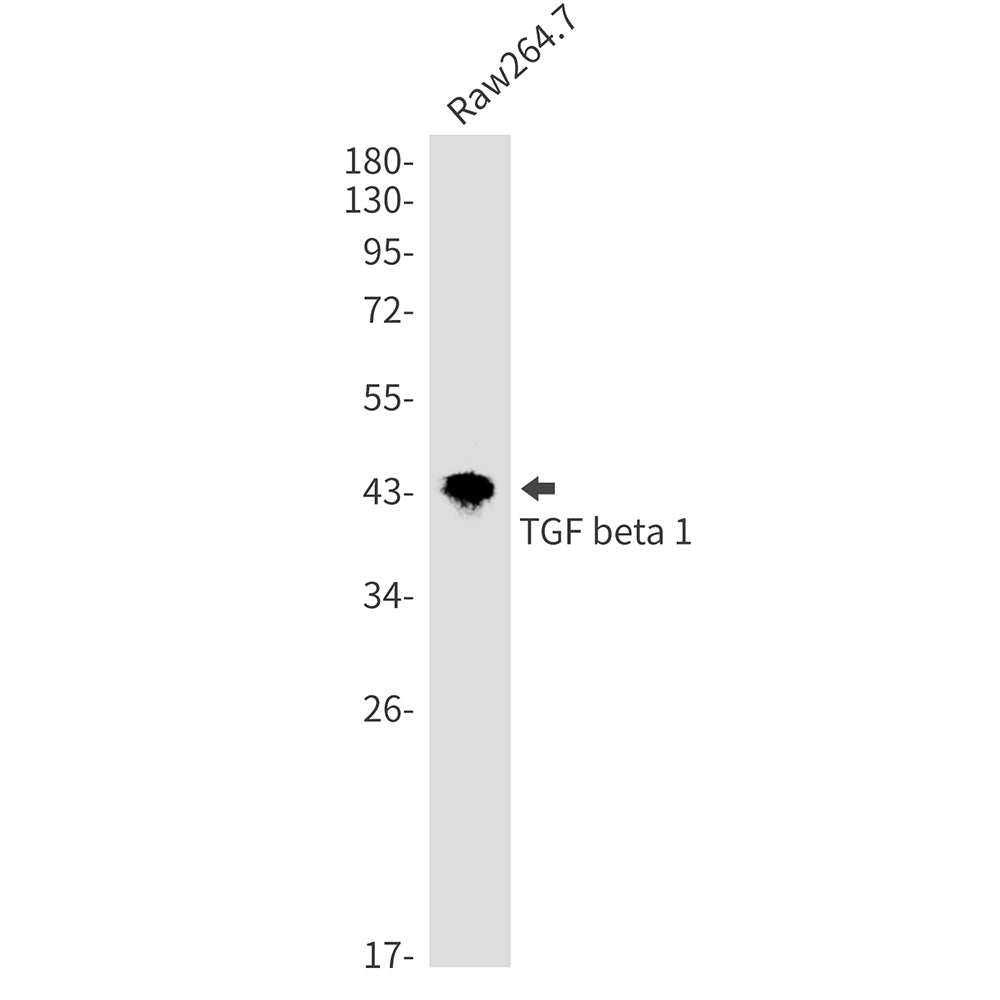 TGF beta 1 Rabbit Monoclonal Antibody