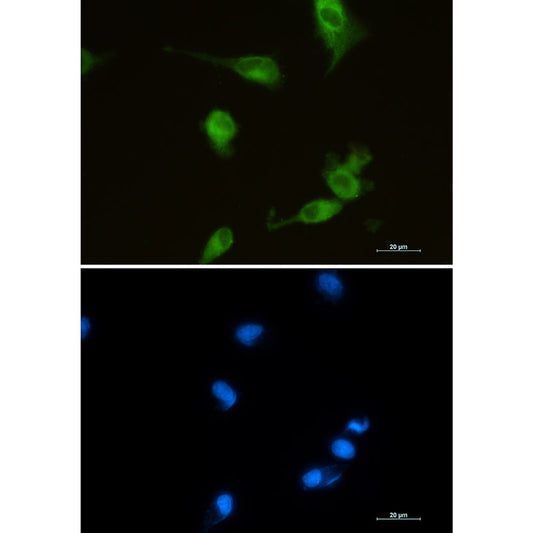 Heme Oxygenase 1 Rabbit Monoclonal Antibody