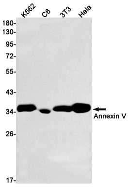 Annexin V Rabbit Monoclonal Antibody