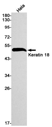 Cytokeratin 18 Rabbit Monoclonal Antibody
