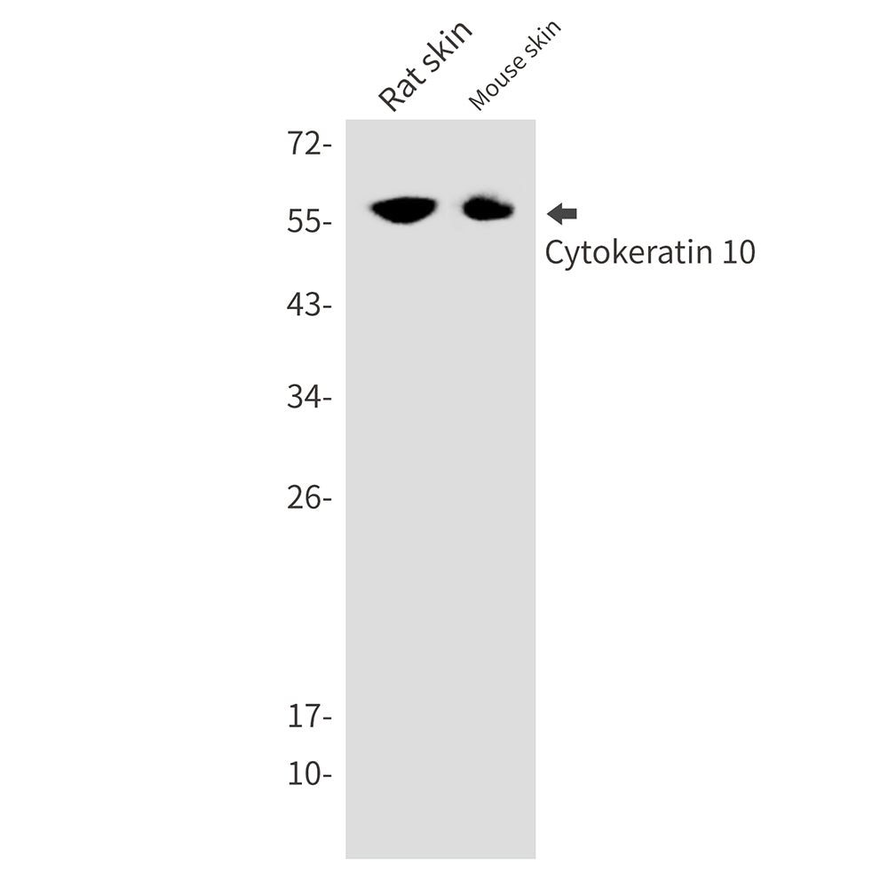 Cytokeratin 10 Rabbit Monoclonal Antibody