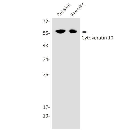 Cytokeratin 10 Rabbit Monoclonal Antibody