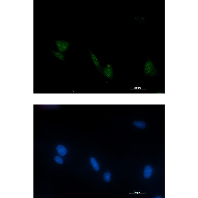 Phospho-RSK4 (Ser232) Rabbit Monoclonal Antibody