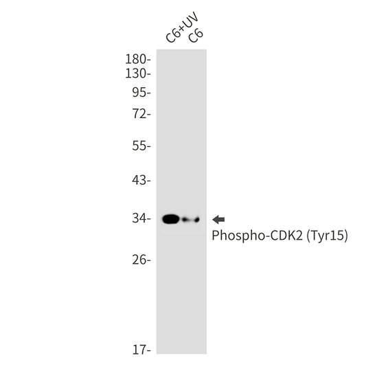 Phospho-CDK2 (Tyr15) Rabbit Monoclonal Antibody