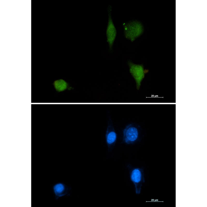 Phospho-delta 1 Catenin (Tyr228) Rabbit Monoclonal Antibody