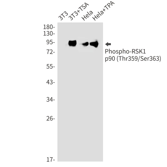 Phospho-RSK1 p90 (Thr359/Ser363) Rabbit Monoclonal Antibody