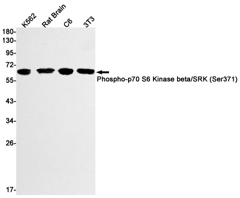 Phospho-S6K2 (Ser371) Rabbit Monoclonal Antibody