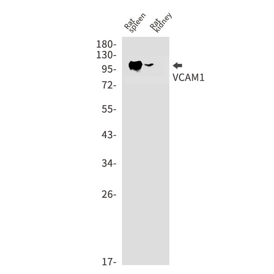VCAM1 Rabbit Monoclonal Antibody