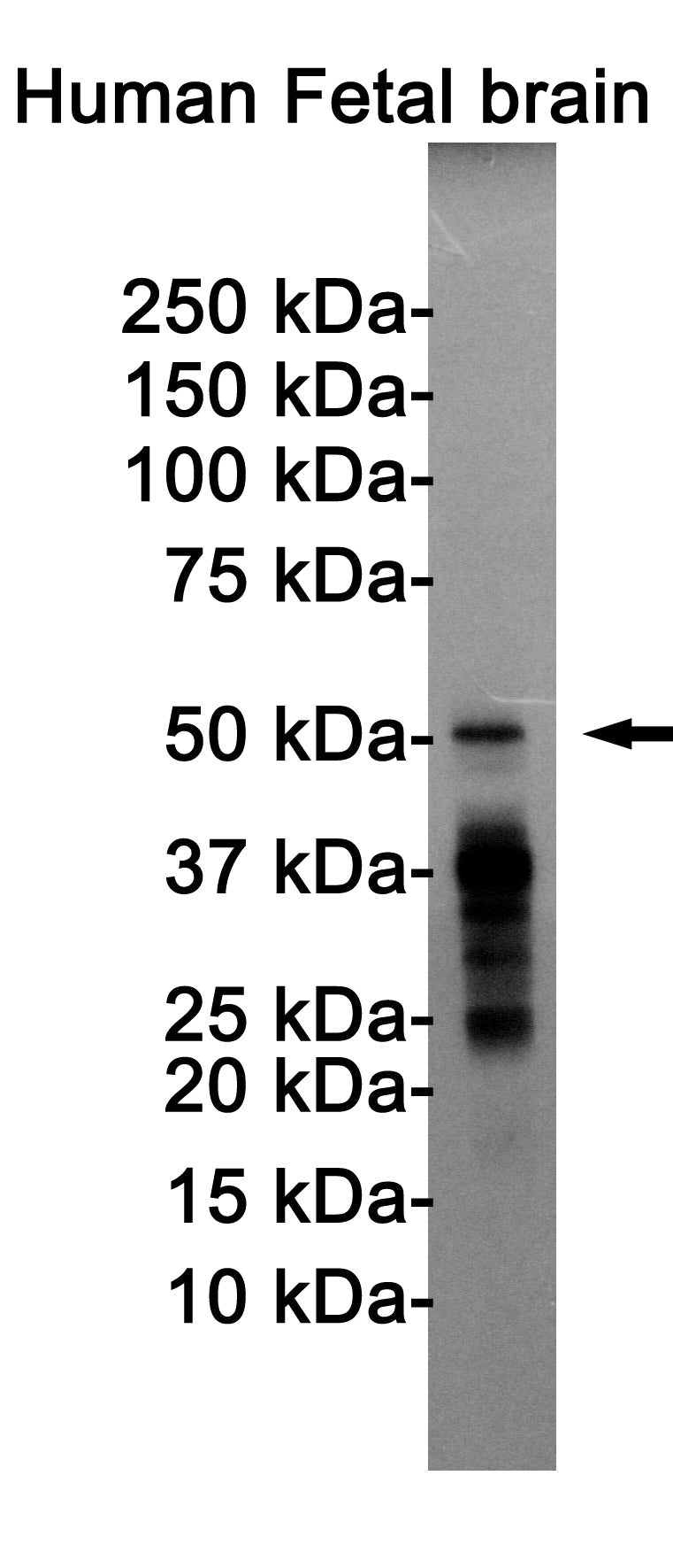 Phospho-Tau (Thr205) Rabbit Monoclonal Antibody